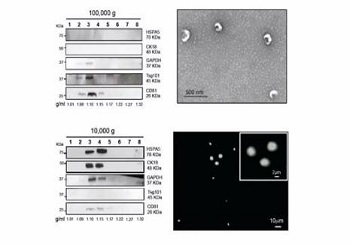 Exosome：為腫瘤臨床診斷和治療帶來新的契機